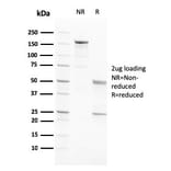 SDS-PAGE - Anti-PAPP A Antibody [PAPPA/2717] - BSA and Azide free (A252737) - Antibodies.com