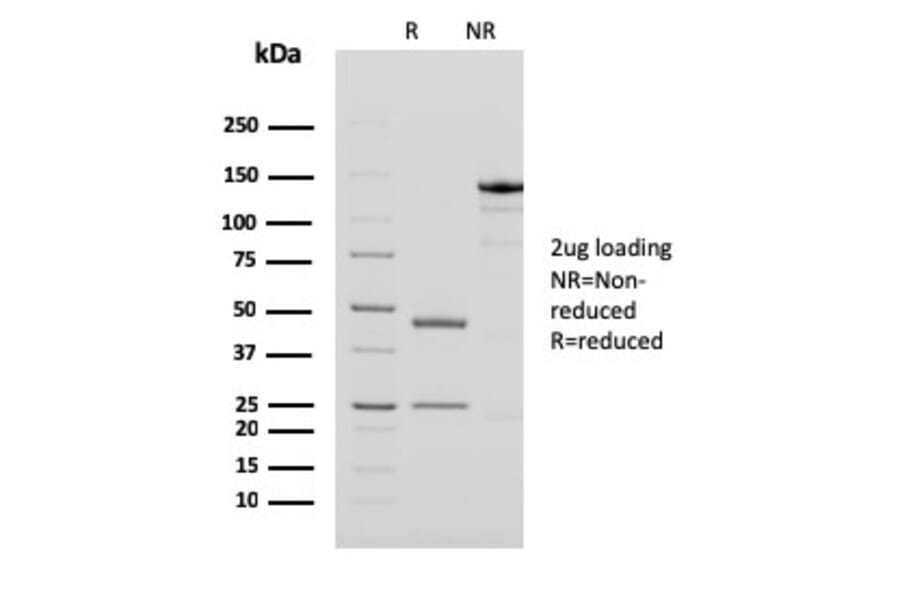SDS-PAGE - Anti-PAPP A Antibody [PAPPA/2718] - BSA and Azide free (A252738) - Antibodies.com