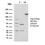 SDS-PAGE - Anti-PAPP A Antibody [PAPPA/2718] - BSA and Azide free (A252738) - Antibodies.com