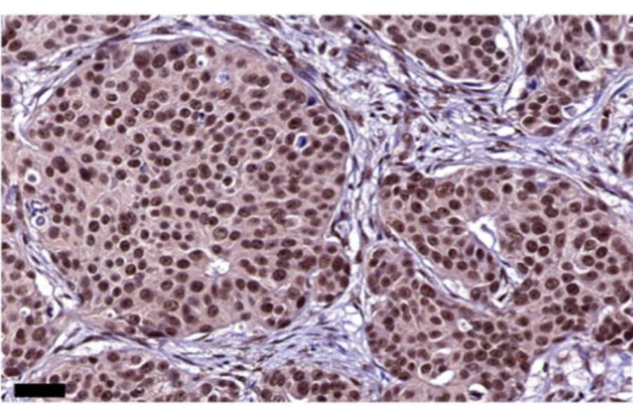 Immunohistochemistry - Anti-PAX2 Antibody [PAX2/1104] - BSA and Azide free (A252739) - Antibodies.com