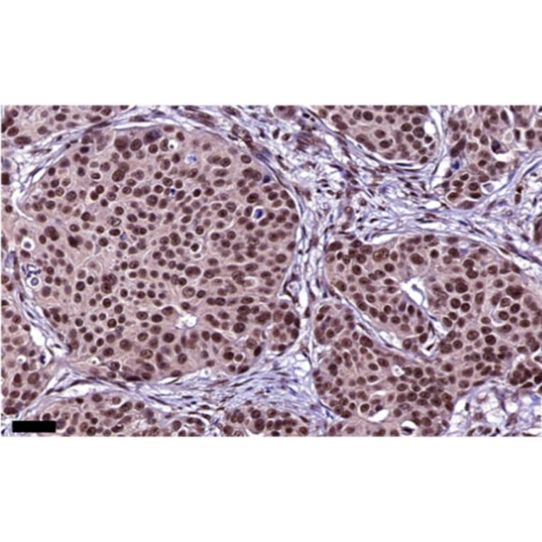 Immunohistochemistry - Anti-PAX2 Antibody [PAX2/1104] - BSA and Azide free (A252739) - Antibodies.com