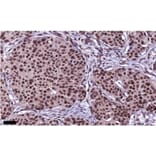 Immunohistochemistry - Anti-PAX2 Antibody [PAX2/1104] - BSA and Azide free (A252739) - Antibodies.com
