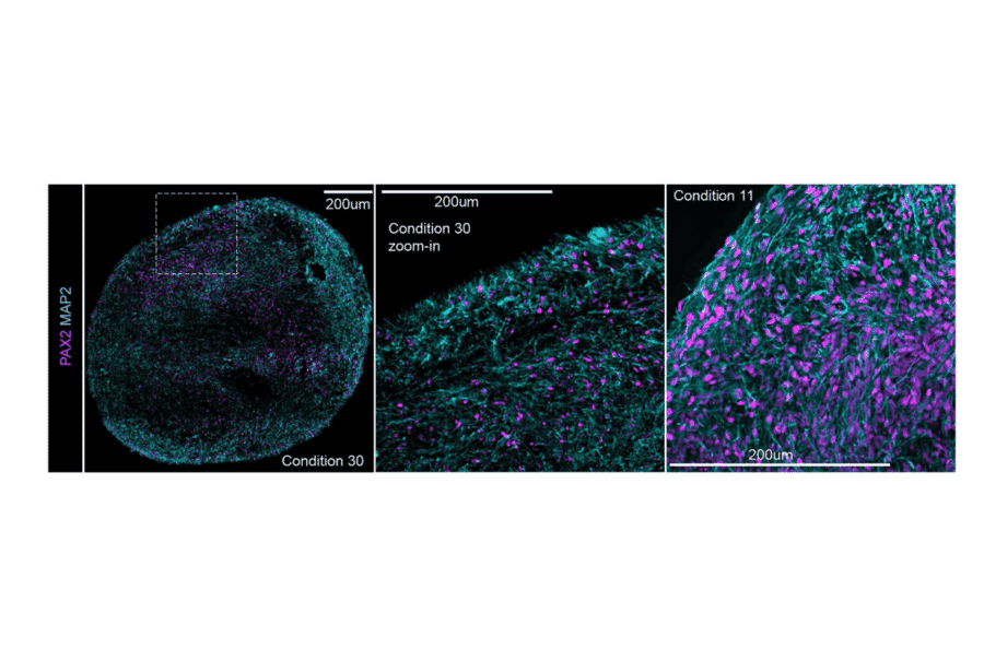 Immunofluorescence - Anti-PAX2 Antibody [PAX2/1104] - BSA and Azide free (A252739) - Antibodies.com Citation