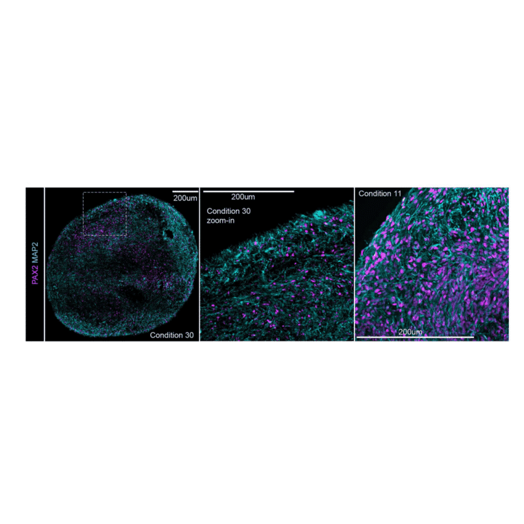 Immunofluorescence - Anti-PAX2 Antibody [PAX2/1104] - BSA and Azide free (A252739) - Antibodies.com Citation