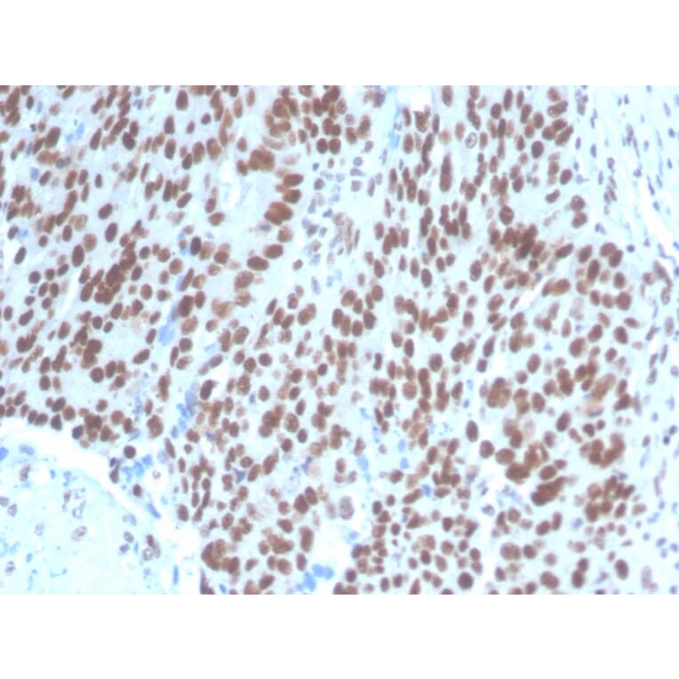 Immunohistochemistry - Anti-PAX2 Antibody [PAX2/1104] - BSA and Azide free (A252739) - Antibodies.com