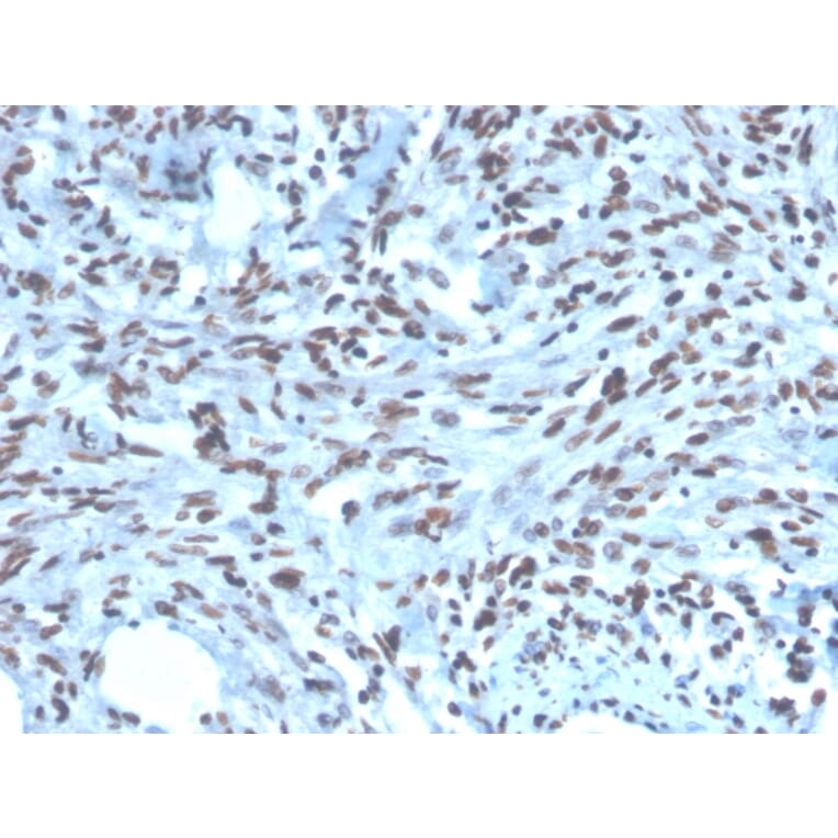 Immunohistochemistry - Anti-PAX2 Antibody [PAX2/1104] - BSA and Azide free (A252739) - Antibodies.com