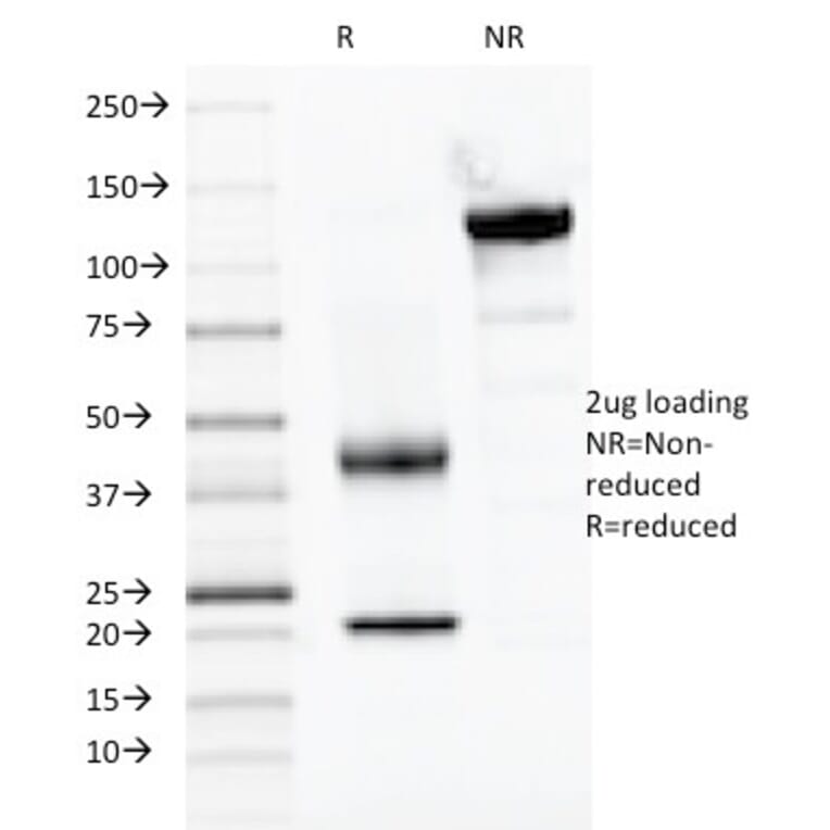SDS-PAGE - Anti-PAX2 Antibody [PAX2/1104] - BSA and Azide free (A252739) - Antibodies.com