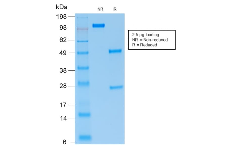 SDS-PAGE - Anti-PAX5 Antibody [rPAX5/2060] - BSA and Azide free (A252739) - Antibodies.com