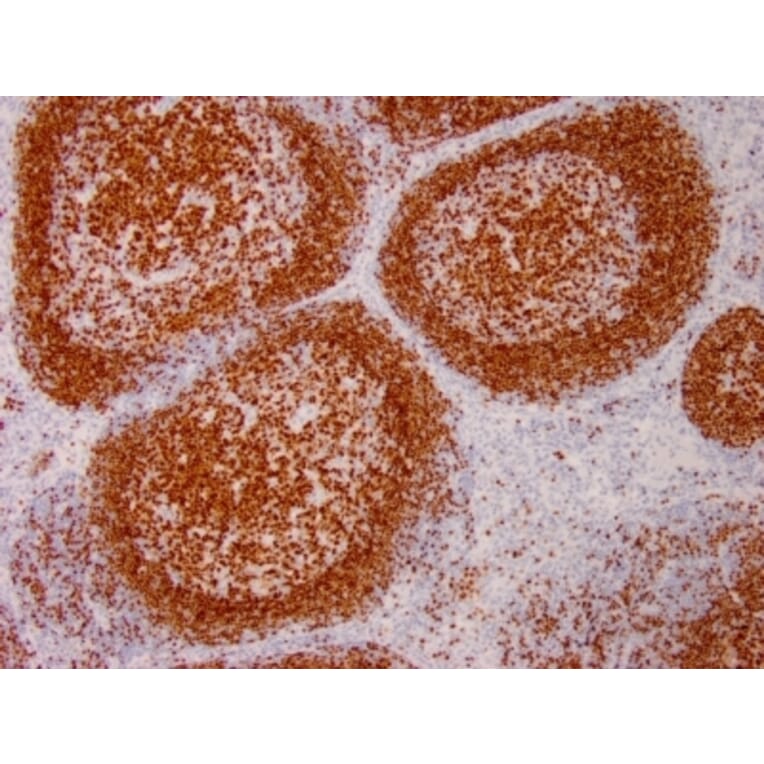 Immunohistochemistry - Anti-PAX5 Antibody [PAX5/3735] - BSA and Azide free (A252743) - Antibodies.com