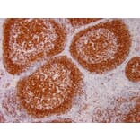 Immunohistochemistry - Anti-PAX5 Antibody [PAX5/3735] - BSA and Azide free (A252743) - Antibodies.com