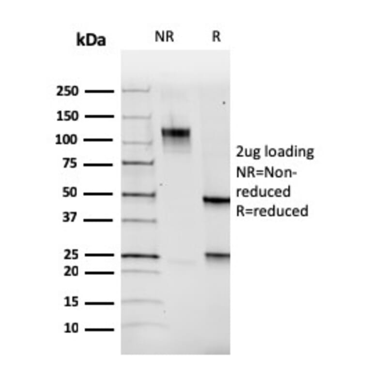 SDS-PAGE - Anti-PAX5 Antibody [PAX5/3735] - BSA and Azide free (A252743) - Antibodies.com