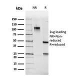 SDS-PAGE - Anti-PAX5 Antibody [PAX5/3735] - BSA and Azide free (A252743) - Antibodies.com