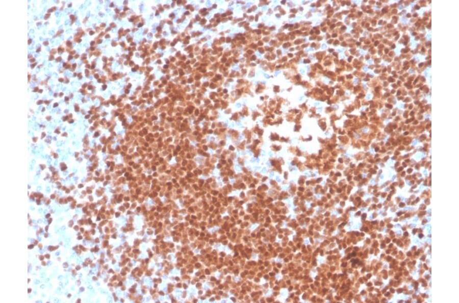 Immunohistochemistry - Anti-PAX5 Antibody [rPAX5/4228] - BSA and Azide free (A252744) - Antibodies.com