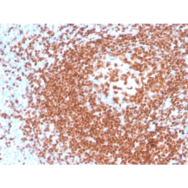 Immunohistochemistry - Anti-PAX5 Antibody [rPAX5/4228] - BSA and Azide free (A252744) - Antibodies.com