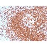 Immunohistochemistry - Anti-PAX5 Antibody [rPAX5/4228] - BSA and Azide free (A252744) - Antibodies.com