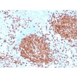 Immunohistochemistry - Anti-PAX5 Antibody [rPAX5/4228] - BSA and Azide free (A252743) - Antibodies.com