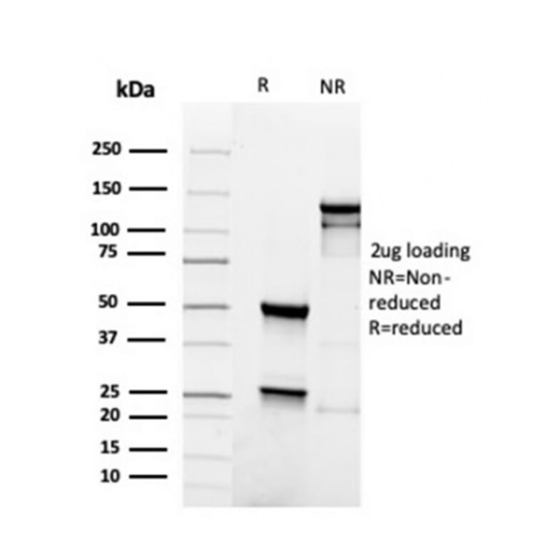 SDS-PAGE - Anti-PAX5 Antibody [rPAX5/4228] - BSA and Azide free (A252744) - Antibodies.com