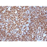 Immunohistochemistry - Anti-PAX5 Antibody [PAX5/3977R] - BSA and Azide free (A252745) - Antibodies.com