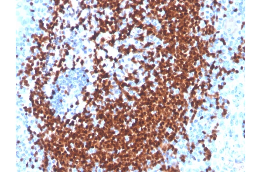 Immunohistochemistry - Anti-PAX5 Antibody [PAX5/3977R] - BSA and Azide free (A252744) - Antibodies.com