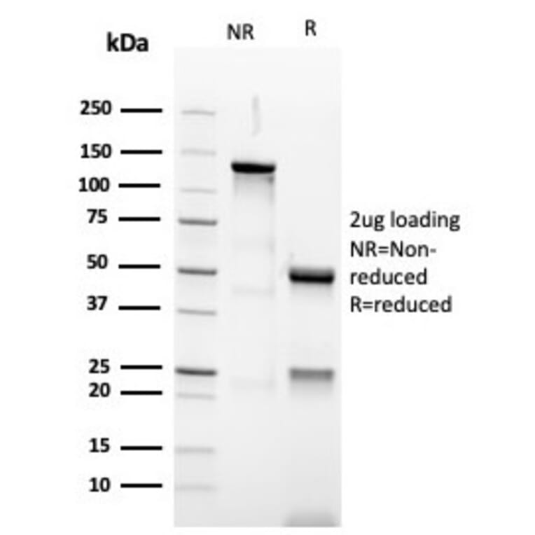 SDS-PAGE - Anti-PAX5 Antibody [PAX5/3977R] - BSA and Azide free (A252745) - Antibodies.com