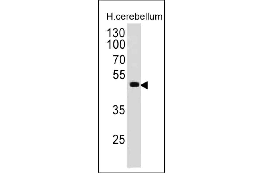 Western Blot - Anti-PAX6 Antibody [PAX6/498] - BSA and Azide free (A252746) - Antibodies.com