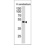 Western Blot - Anti-PAX6 Antibody [PAX6/498] - BSA and Azide free (A252746) - Antibodies.com
