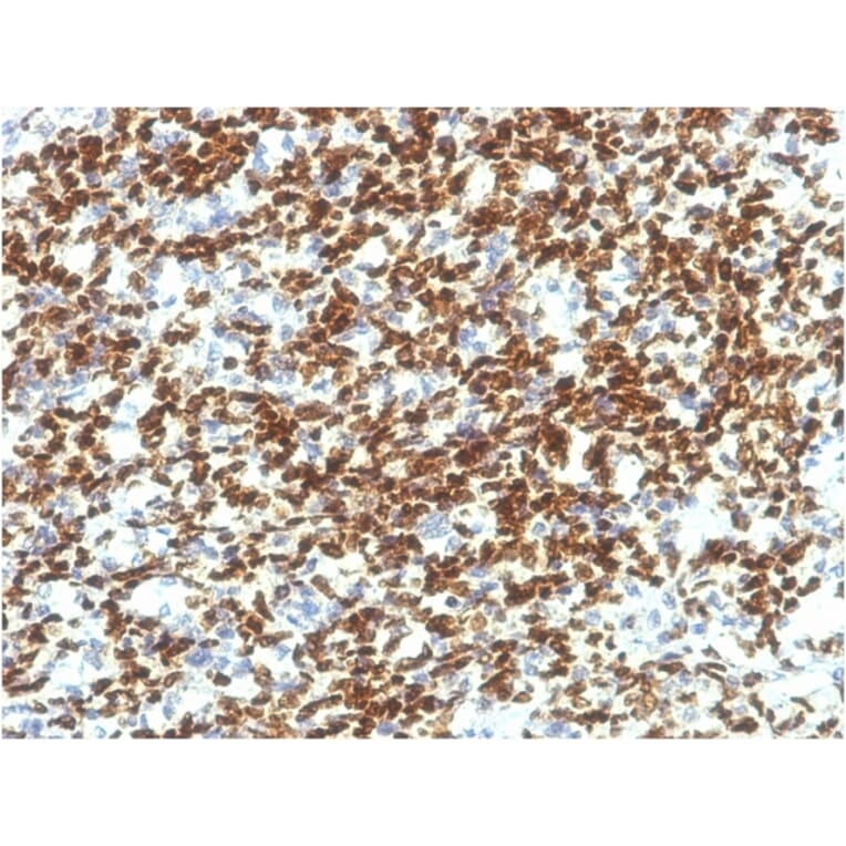 Immunohistochemistry - Anti-PAX7 Antibody [PAX7/1187] - BSA and Azide free (A252749) - Antibodies.com