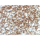 Immunohistochemistry - Anti-PAX7 Antibody [PAX7/1187] - BSA and Azide free (A252749) - Antibodies.com