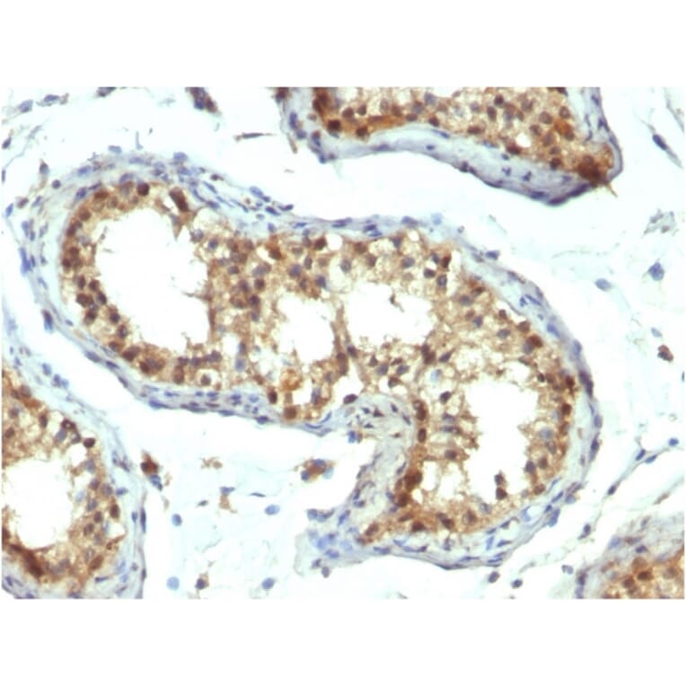 Immunohistochemistry - Anti-PAX7 Antibody [PAX7/1187] - BSA and Azide free (A252750) - Antibodies.com