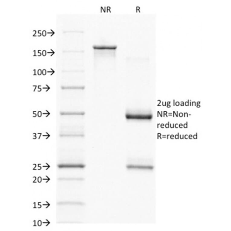 SDS-PAGE - Anti-PAX7 Antibody [PAX7/1187] - BSA and Azide free (A252750) - Antibodies.com