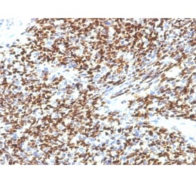 Immunohistochemistry - Anti-PAX7 Antibody [SPM613] - BSA and Azide free (A252750) - Antibodies.com