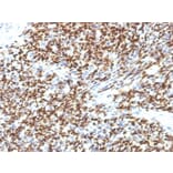 Immunohistochemistry - Anti-PAX7 Antibody [SPM613] - BSA and Azide free (A252750) - Antibodies.com