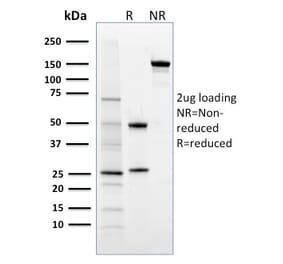 SDS-PAGE - Anti-FOXP3 Antibody [3G3] - BSA and Azide free (A252751) - Antibodies.com
