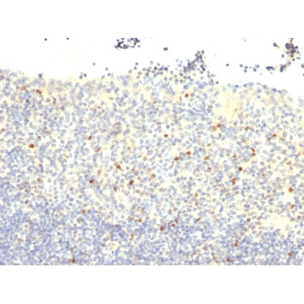 Immunohistochemistry - Anti-FOXP3 Antibody [FXP3/197] - BSA and Azide free (A252753) - Antibodies.com