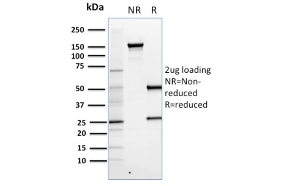 SDS-PAGE - Anti-FOXP3 Antibody [FXP3/197] - BSA and Azide free (A252753) - Antibodies.com