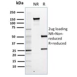 SDS-PAGE - Anti-FOXP3 Antibody [FXP3/197] - BSA and Azide free (A252753) - Antibodies.com