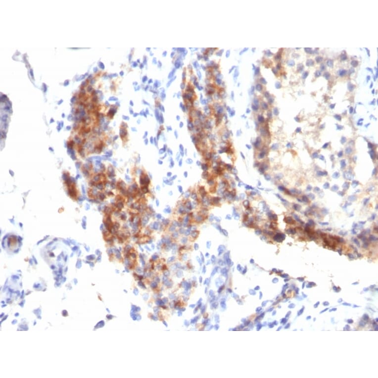 Immunohistochemistry - Anti-FOXP3 Antibody [SPM579] - BSA and Azide free (A252753) - Antibodies.com