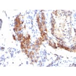 Immunohistochemistry - Anti-FOXP3 Antibody [SPM579] - BSA and Azide free (A252753) - Antibodies.com