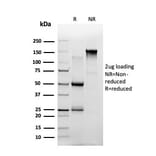 SDS-PAGE - Anti-ThPok Antibody [PCRP-ZBTB7B-1B6] - BSA and Azide free (A252755) - Antibodies.com