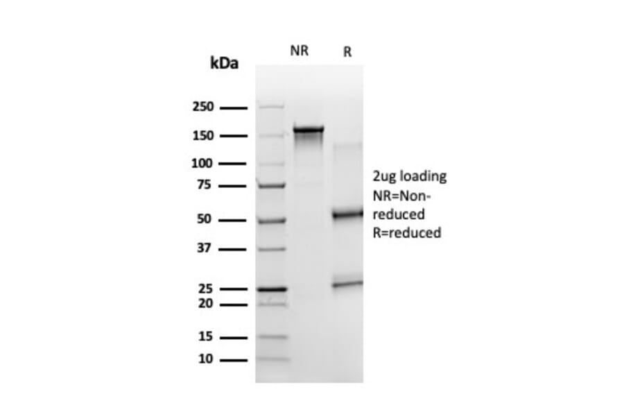 SDS-PAGE - Anti-ZBTB7B Antibody [PCRP-ZBTB7B-1F7] - BSA and Azide free (A252756) - Antibodies.com