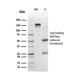 SDS-PAGE - Anti-ZBTB7B Antibody [PCRP-ZBTB7B-1F7] - BSA and Azide free (A252756) - Antibodies.com