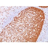 Immunohistochemistry - Anti-PCNA Antibody [PC10] - BSA and Azide free (A252758) - Antibodies.com