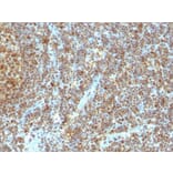 Immunohistochemistry - Anti-PCNA Antibody [SPM350] - BSA and Azide free (A252758) - Antibodies.com