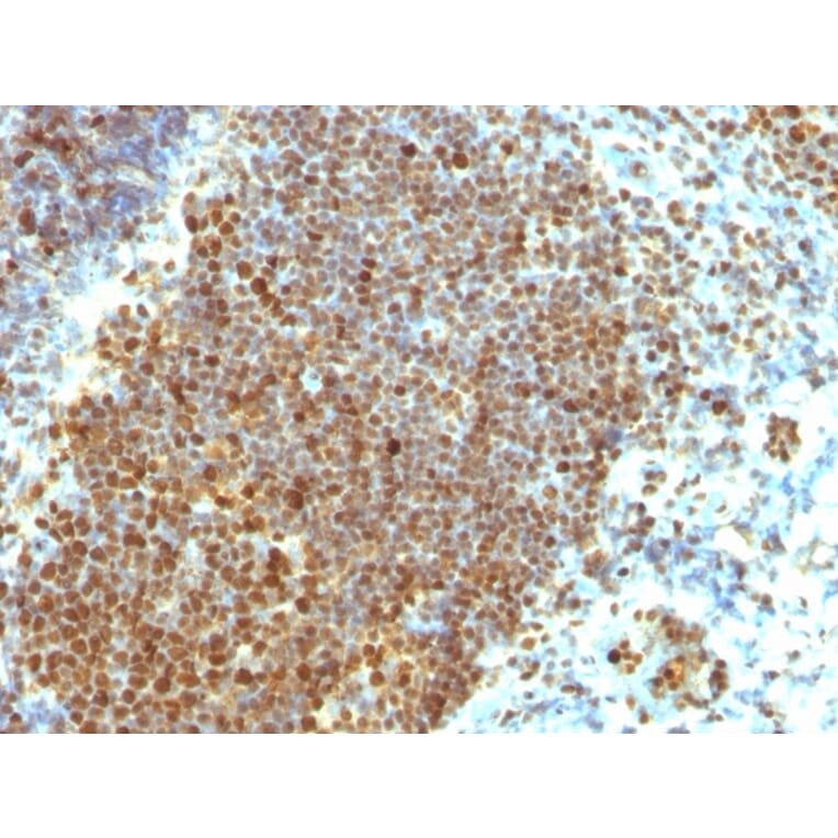 Immunohistochemistry - Anti-PCNA Antibody [PCNA/694] - BSA and Azide free (A252760) - Antibodies.com