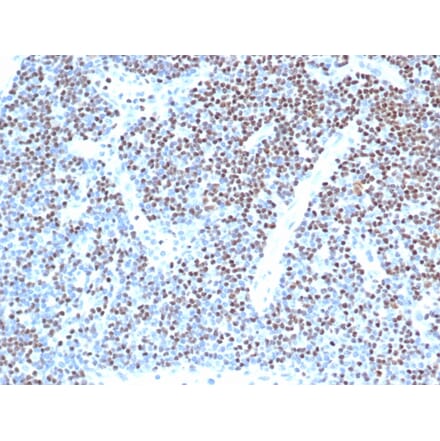 Immunohistochemistry - Anti-LEF1 Antibody [LEF1/341R] - BSA and Azide free (A252761) - Antibodies.com
