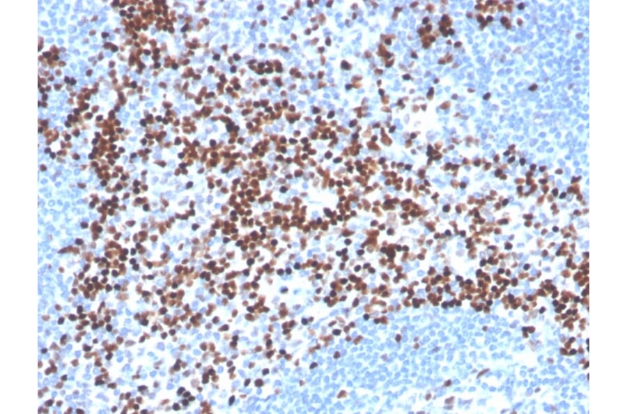 Immunohistochemistry - Anti-LEF1 Antibody [LEF1/341R] - BSA and Azide free (A252762) - Antibodies.com