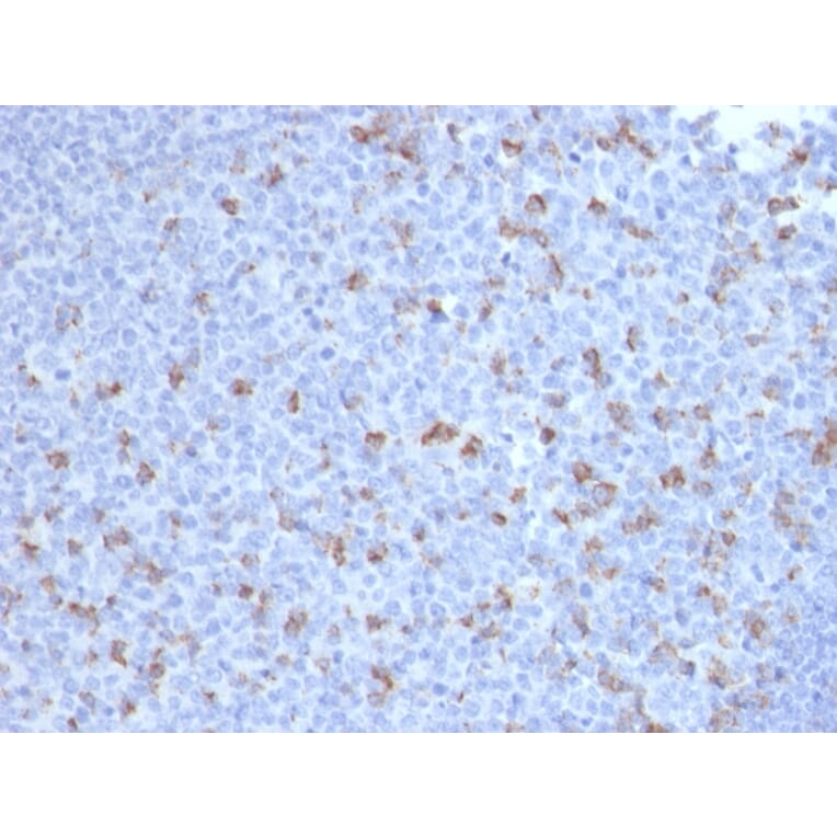 Immunohistochemistry - Anti-PD1 Antibody [PDCD1/2720] - BSA and Azide free (A252764) - Antibodies.com