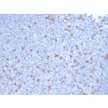 Immunohistochemistry - Anti-PD1 Antibody [PDCD1/2720] - BSA and Azide free (A252764) - Antibodies.com