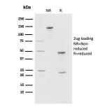 SDS-PAGE - Anti-PD1 Antibody [PDCD1/2720] - BSA and Azide free (A252764) - Antibodies.com