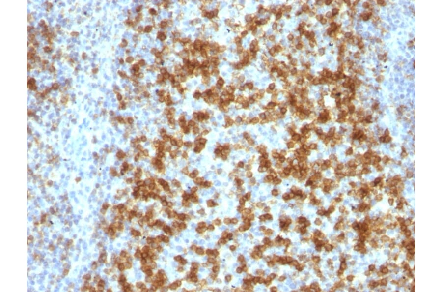 Immunohistochemistry - Anti-PD1 Antibody [PDCD1/922] - BSA and Azide free (A252765) - Antibodies.com